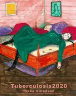 TUBERCULOSIS 2020