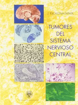 TUMORES DEL SISTEMA NERVIOSO CENTRAL